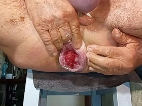 扩肛侠2025-14 japan detached porn onsen